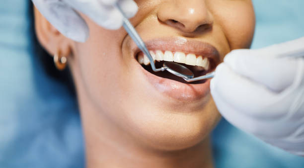 Best Emergency Tooth Extraction in Peachtree City, GA