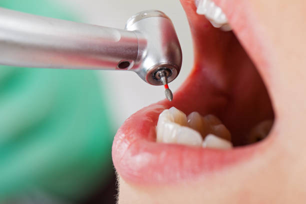 Best Emergency Dental Surgery in Peachtree City, GA